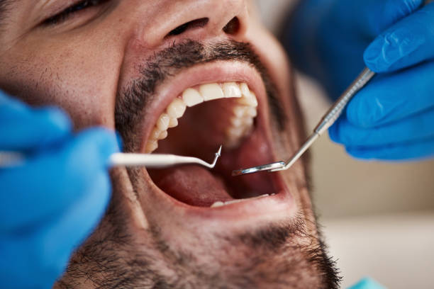 Emergency Dental Services in Salem, NC